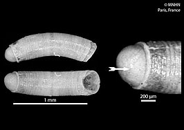 Caecum inflatum