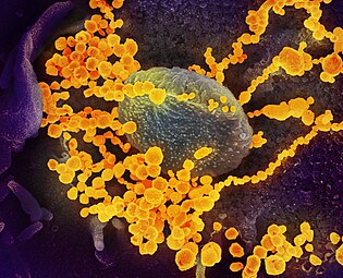 SARS-CoV-2 (yellow) emerging from a human cell