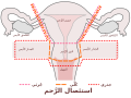 العربيَّة