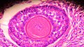 A histological slide of a human primary ovarian follicle in greater magnification