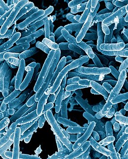 Vi khuẩn Mycobacterium tuberculosis