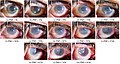 Postmortem changes of the eye (CC-BY 4.0 license), by Aidan Boyd, Shivangi Yadav, Thomas Swearingen, Andrey Kuehlkamp, Mateusz Trokielewicz, Eric Benjamin, P. Maciejewicz, D. Chute, A. Ross, P. Flynn, K. Bowyer, A. Czajka