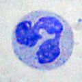 A Neutrophil granulocyte, a kind of white blood cell.