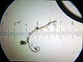   A dead nematode, killed by the fungus Harposporium anguillulae.