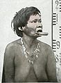 Botokudenfrau (Brasilien) mit dem Pflock (botoque) in der Unterlippe.