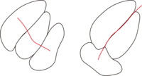 Transgranular crack