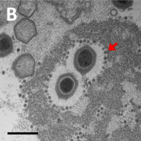 TEM-Aufnahme von Sputnik-Virionen, die an Mimivirus-Fibrillen gebunden sind. (Balken 500 nm).[8]