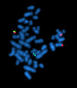 Metaphasechromosomen (blau) mit Nachweis einer Translokation durch den Einsatz zweier genspezifischer Sonden (grün und rot), siehe Philadelphia-Chromosom