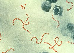 Πυογόνος στρεπτόκοκκος (Streptococcus pyogenes)