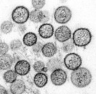 Electron micrograph of Sin Nombre virus, a hantavirus