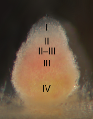 De verschillende zones bij Medicago, geïnoculeerd met Sinorhizobium meliloti