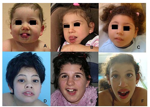 6 children's faces