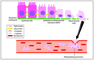 Het EMT-proces naar kanker