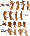 Small proximal femora