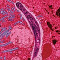 Spindelförmiger Plasmodium-Sporozoit in Darm-Epithelzellen von Anopheles stephensi. Falschfarben-EM-Aufnahme