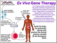 Ex vivo gene therapy