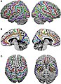 Different views of the sulci of the brain[22]