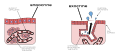 Here is a diagram that shows the differences between Endocrine and Exocrine glands. The major difference is that Exocrine glands secrete substances out of the body and Endocrine glands secrete substances into capillaries and blood vessels.