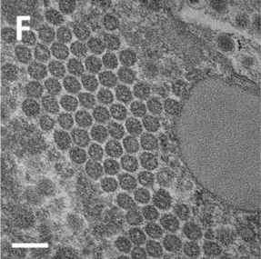 TEM-Aufnahme neugebildeter reifer Sputnik-Virionen.[8]