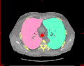 Image segmentation