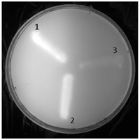 Lipase test results