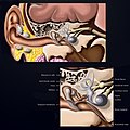 Temporal bone cartoon.jpg